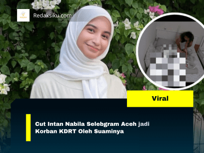 Cut Intan Nabila Selebgram Aceh Korban Kdrt Suami