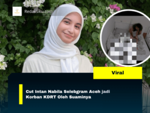 Cut Intan Nabila Selebgram Aceh jadi Korban KDRT Oleh Suaminya 1 Cut Intan Nabila Selebgram Aceh jadi Korban KDRT Oleh Suaminya