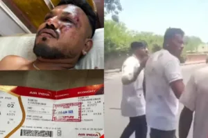 Fakta Baru Kecelakaan Pesawat Air India AI171, Satu Korban Selamat Ungkap Detik-Detik Mencekam Terjadi 1 Pesawat Air India AI171 jatuh di Ahmedabad, satu penumpang ditemukan selamat dan kini dalam perawatan intensif. (Foto: Instagram @lambe_turah)